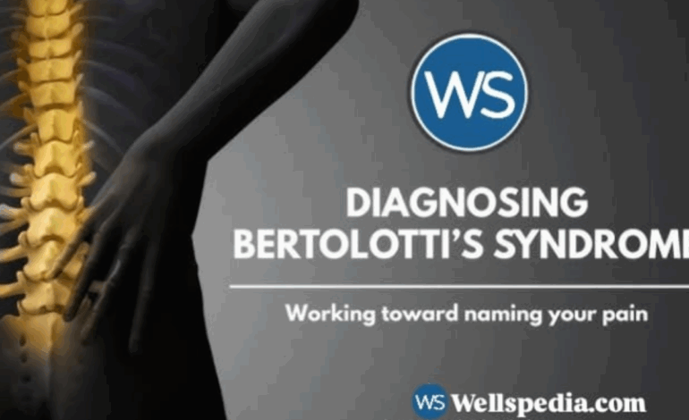 Bertolotti Syndrome: An Often Missed Cause of Chronic Lower Back Pain