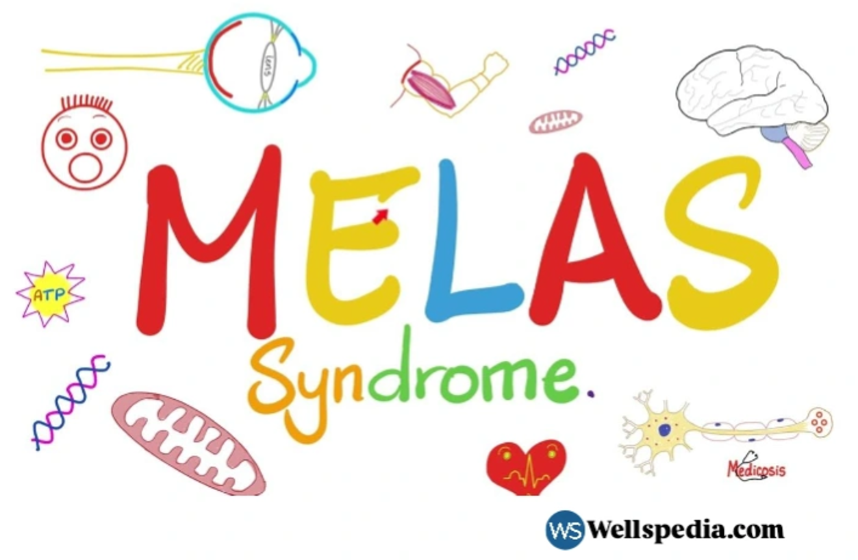 Understanding MELAS Syndrome: Causes, Symptoms, Diagnosis, Treatment, and Future Therapies