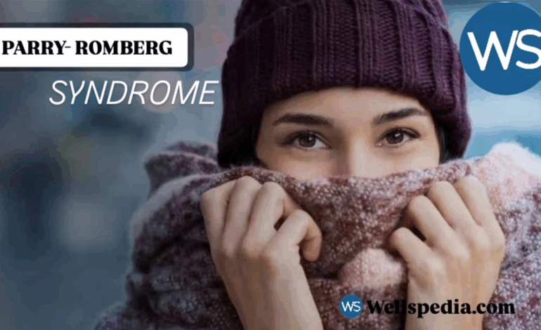Parry Romberg Syndrome: Symptoms, Causes, Diagnosis & Treatment