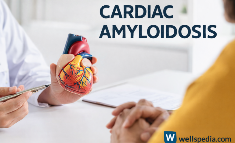 Cardiac Amyloidosis illustration
