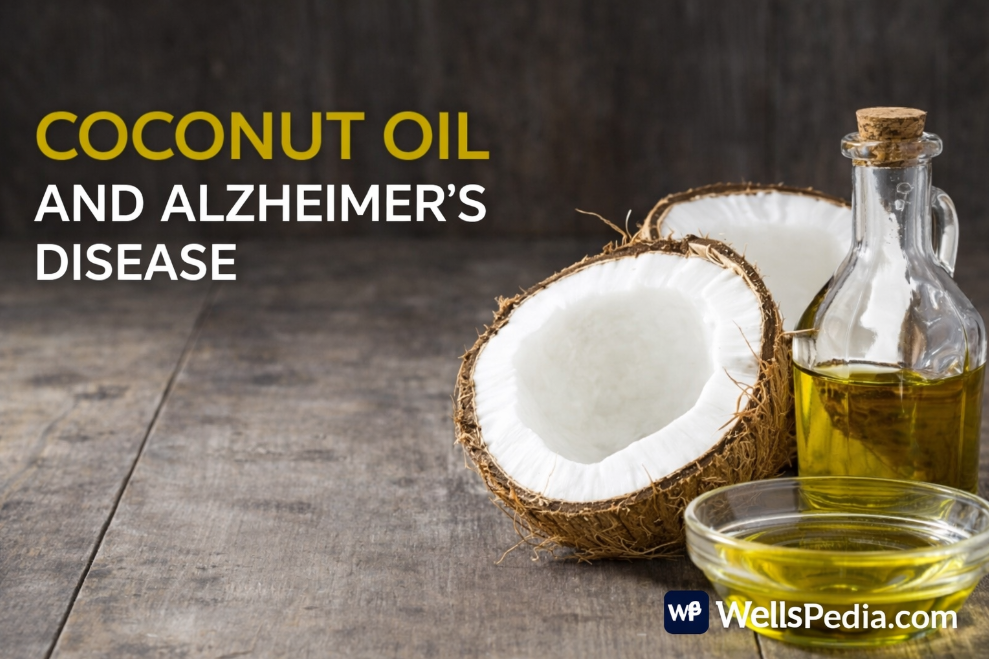 Can Coconut Oil Help Fight Alzheimer’s Disease? Understanding the Science